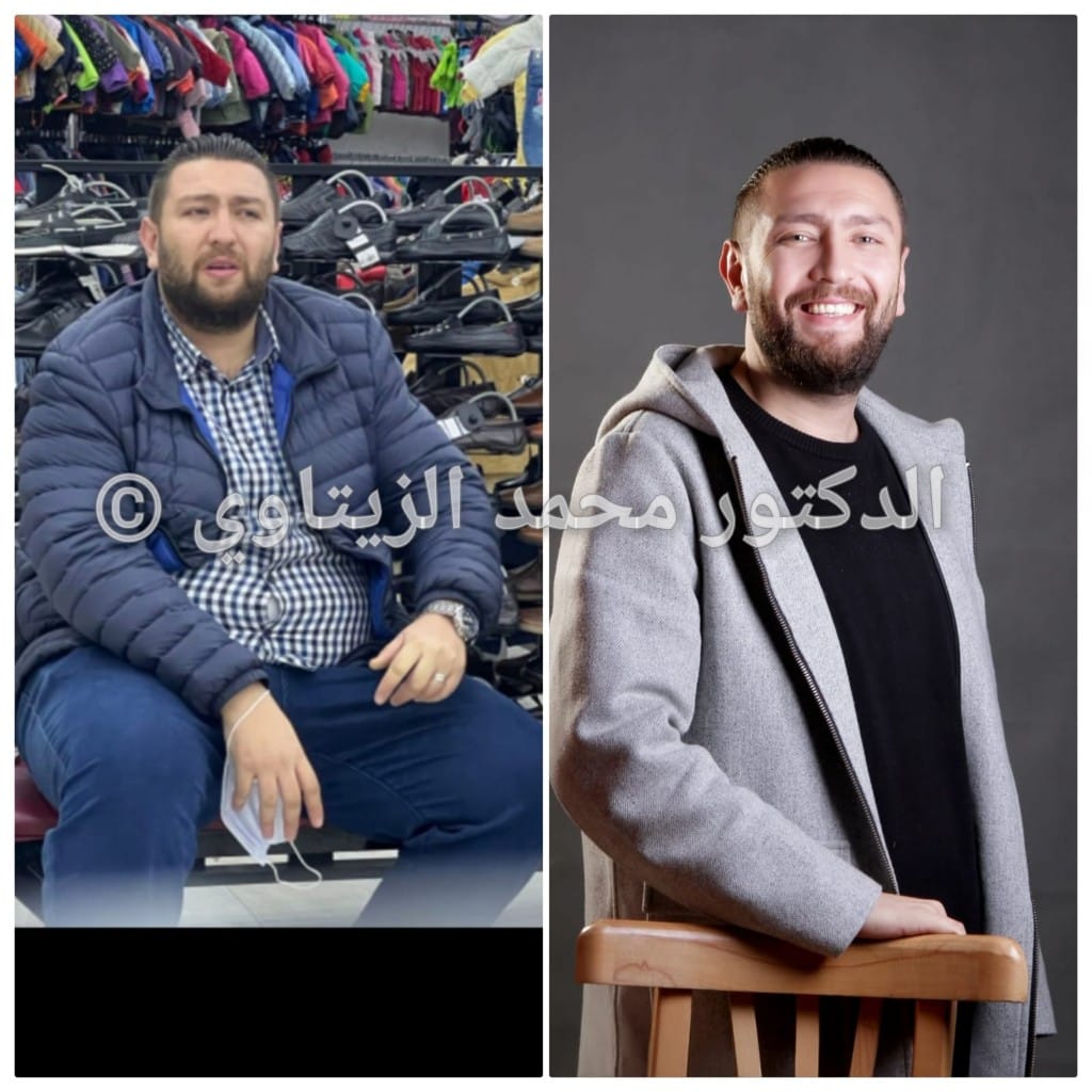 before-after (1)