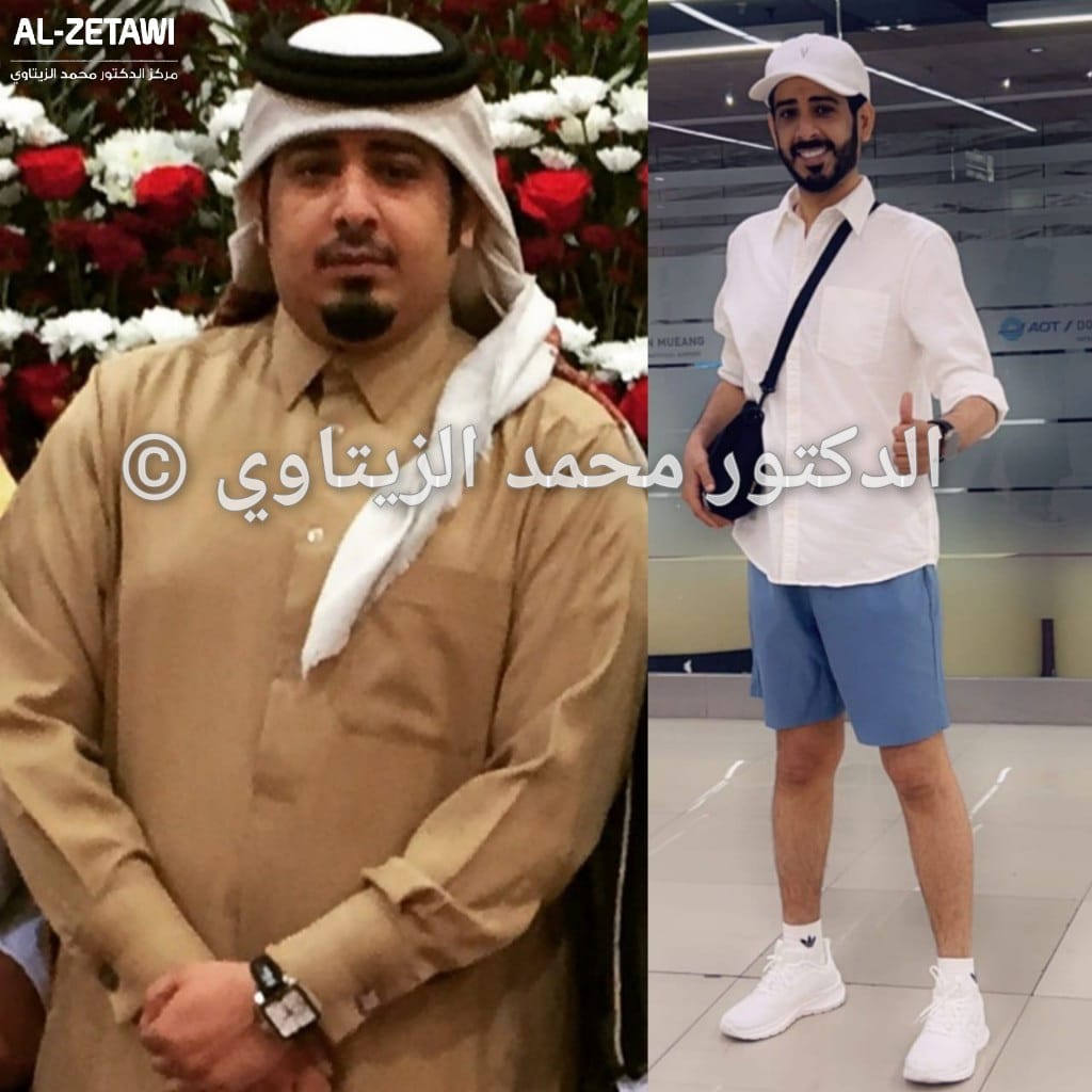 before-after (10)