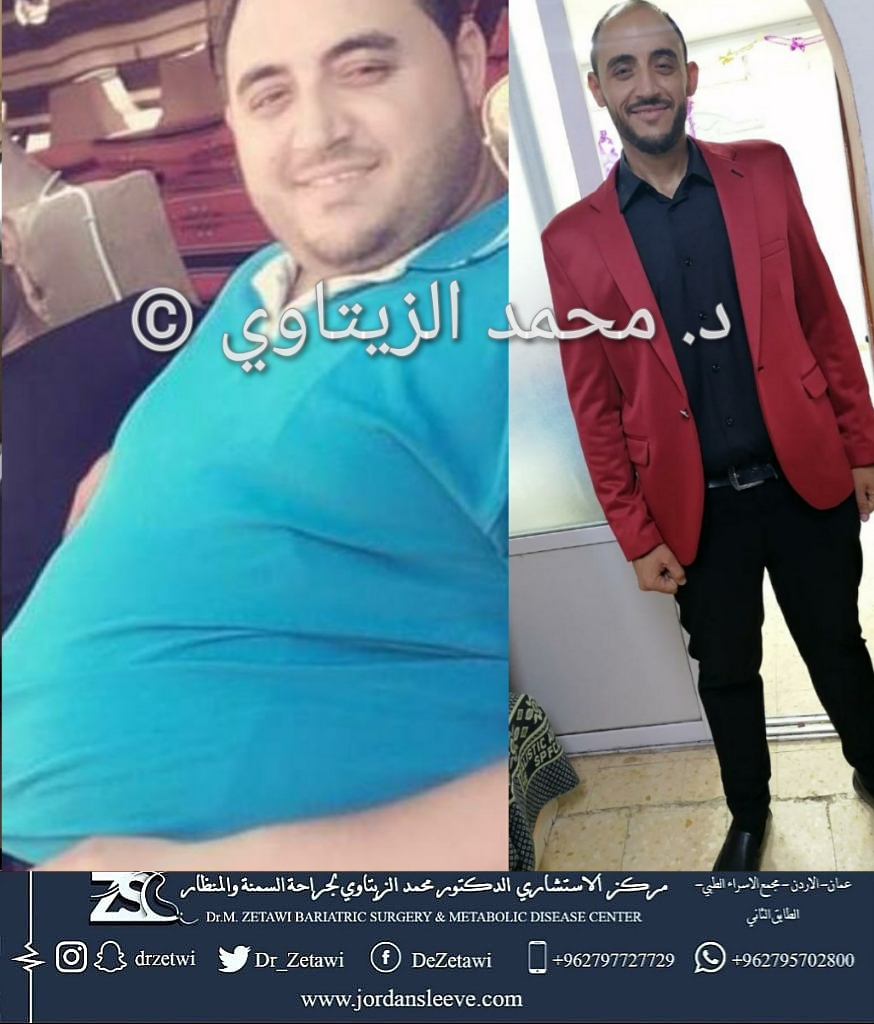 before-after (11)