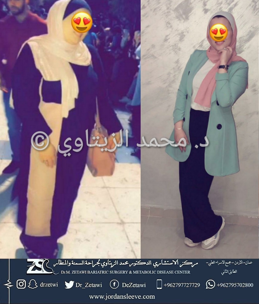 before-after (12)