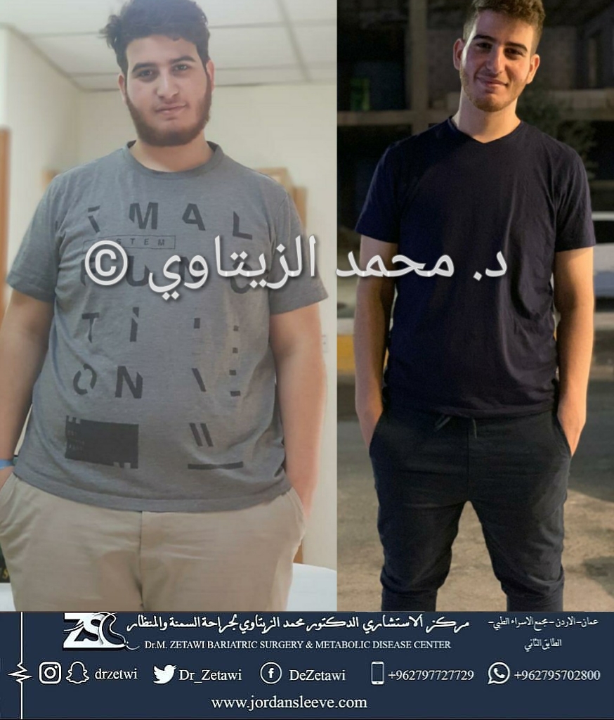 before-after (13)