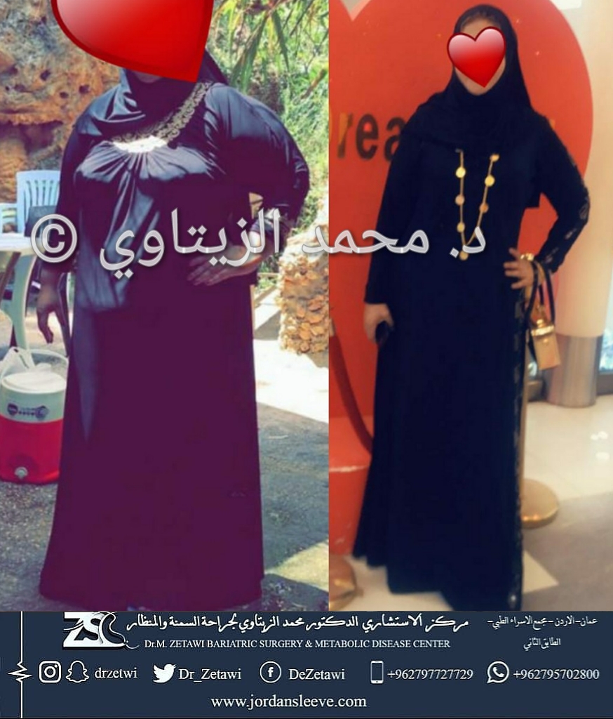 before-after (14)