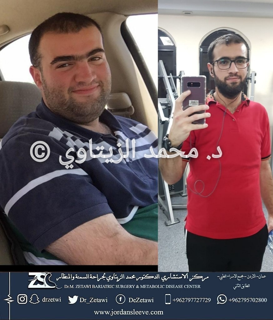 before-after (15)