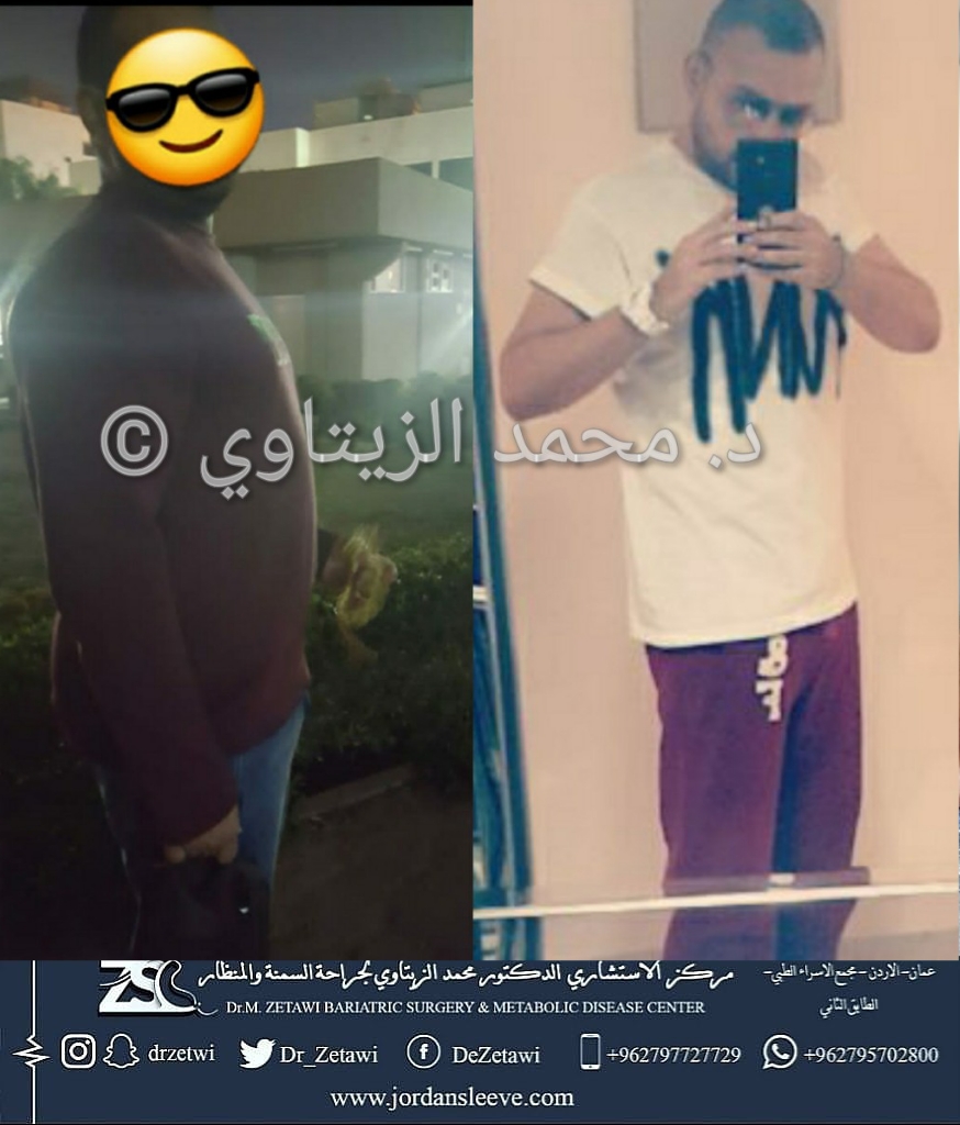 before-after (16)