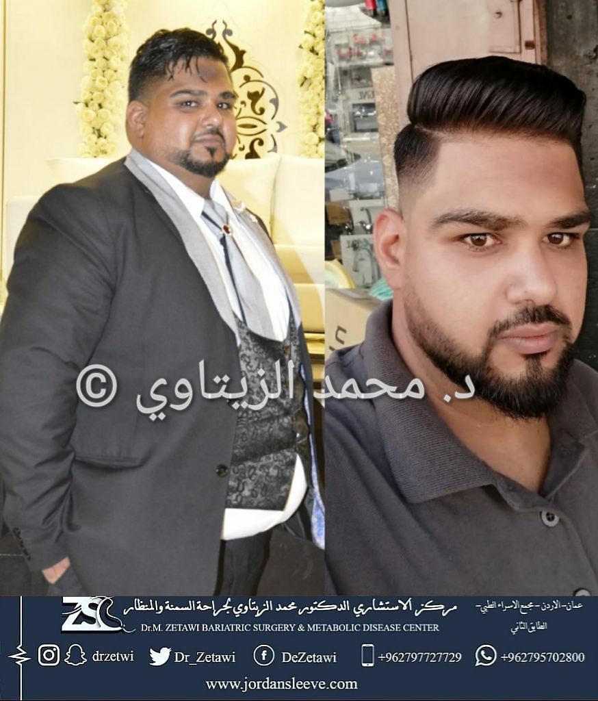 before-after (20)