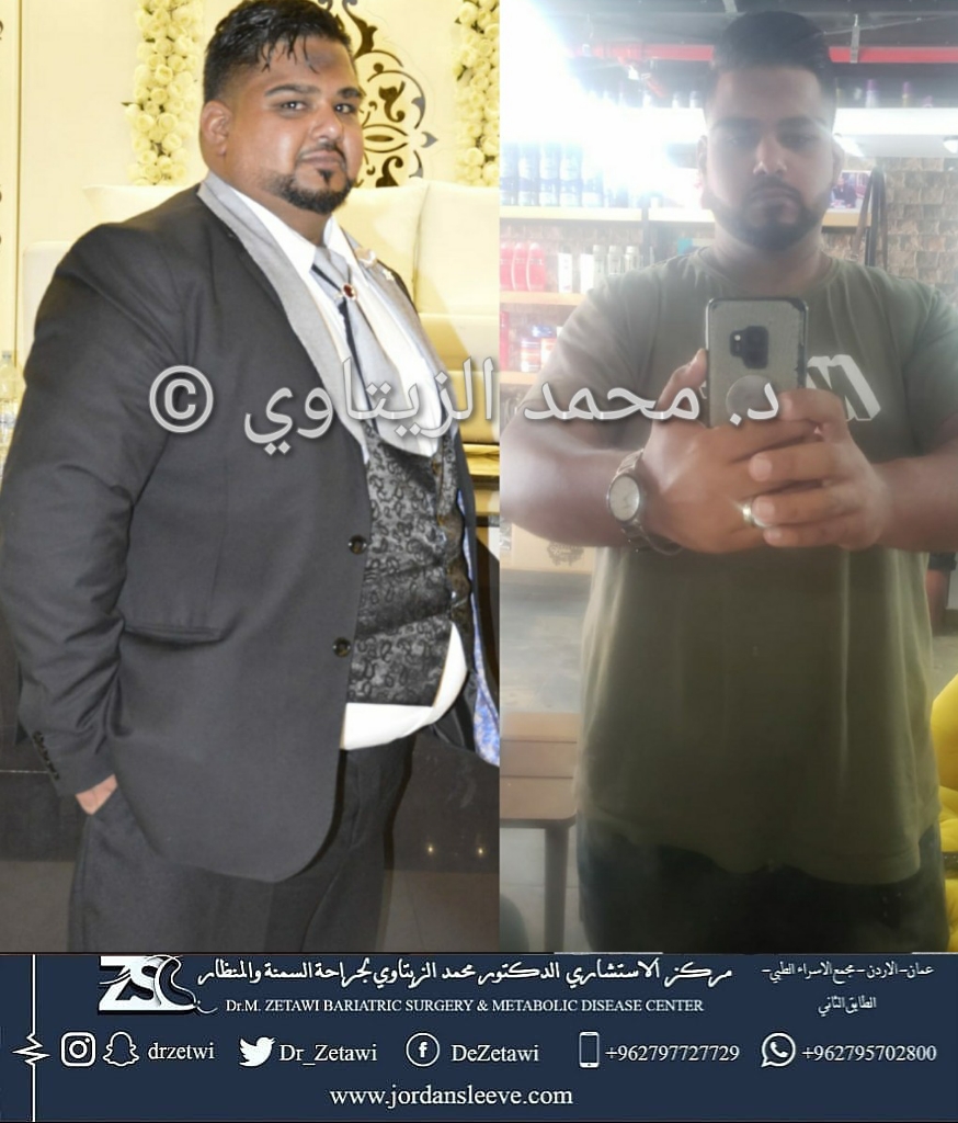 before-after (22)