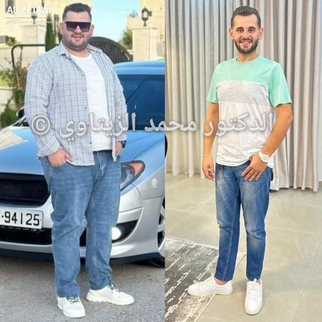before-after (3)