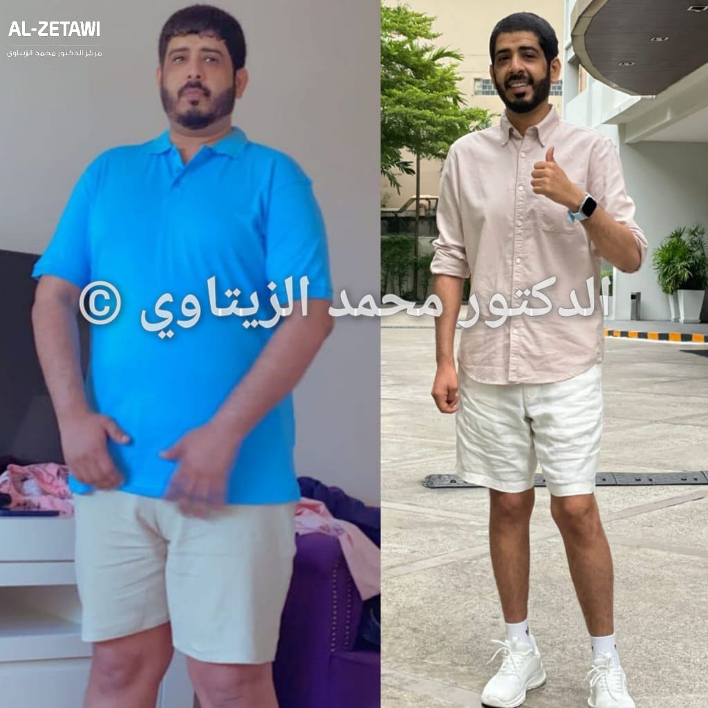 before-after (7)